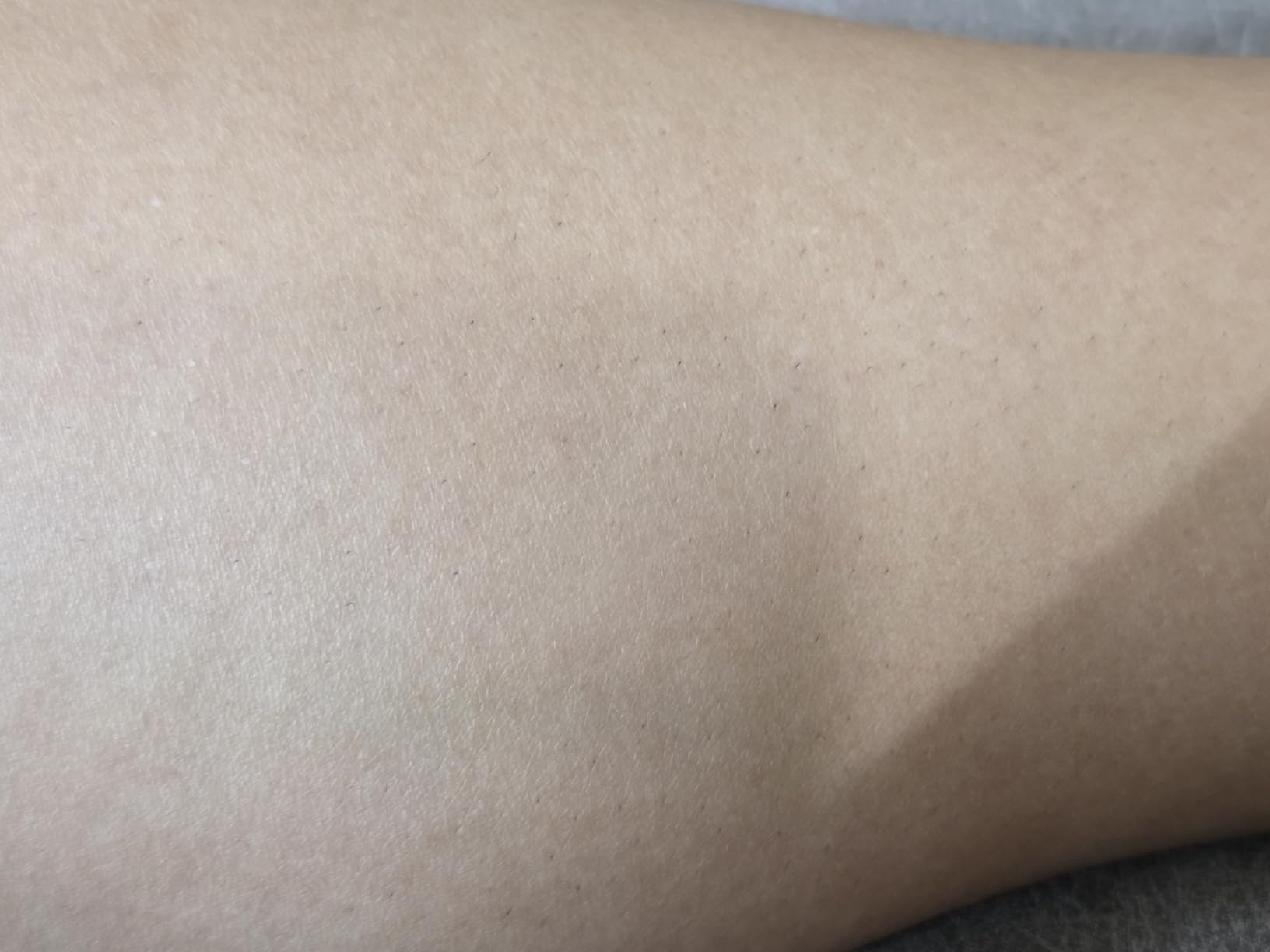 Braun IPL, Silk·Expert Pro 5, IPL Hair Removal for Women and Men, Permanent Laser Hair Reduction At-Home, 2 Heads, Pouch, IPL5137 customer photo 1