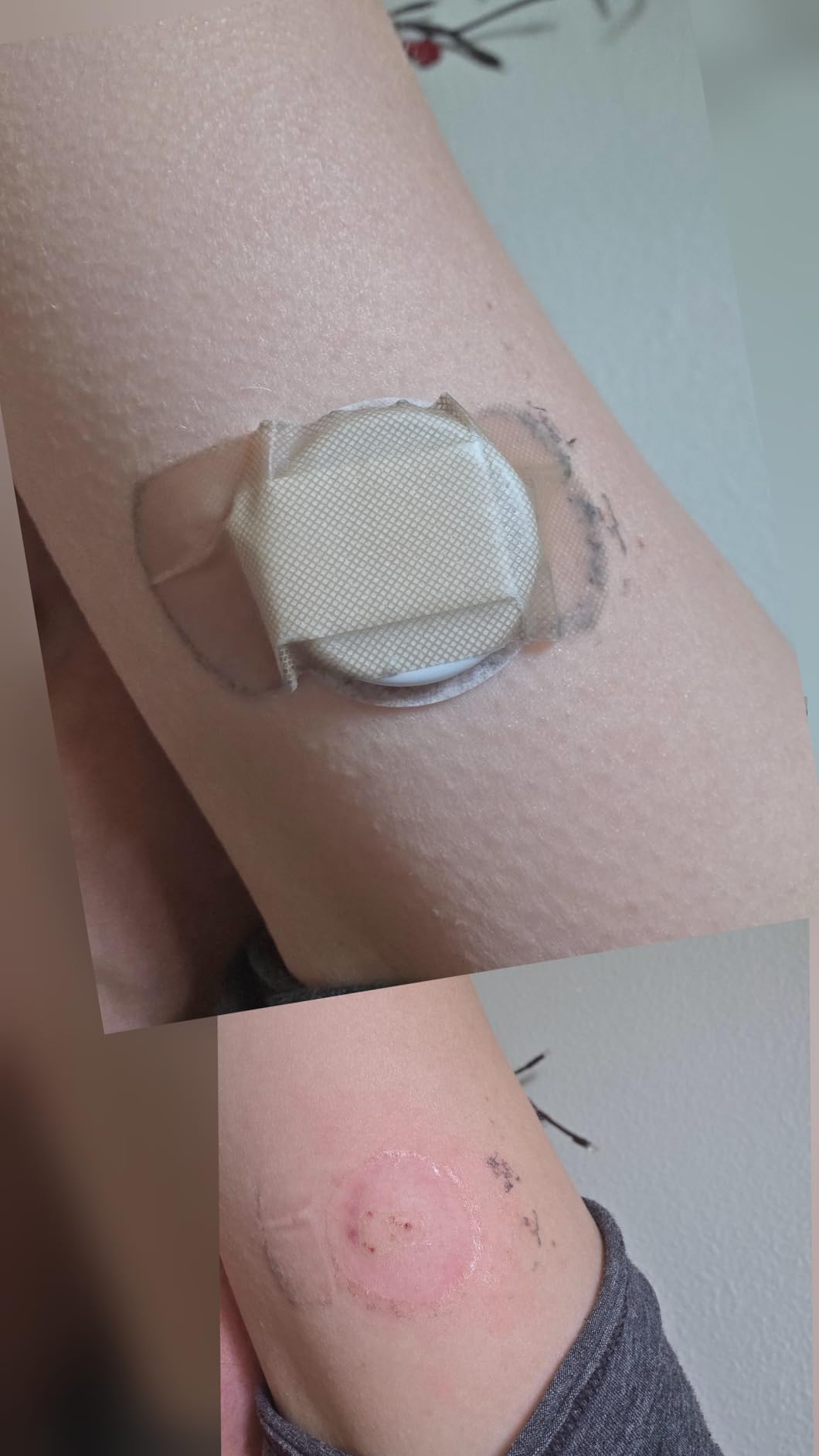 Lingo Continuous Glucose Monitor (CGM). Made by Abbott. Optimize Your Nutrition with Real-time Glucose Data & Insights. 1 Lingo biosensor lasts up to 14 Days. Works with iOS and Android. US Only. customer photo 2