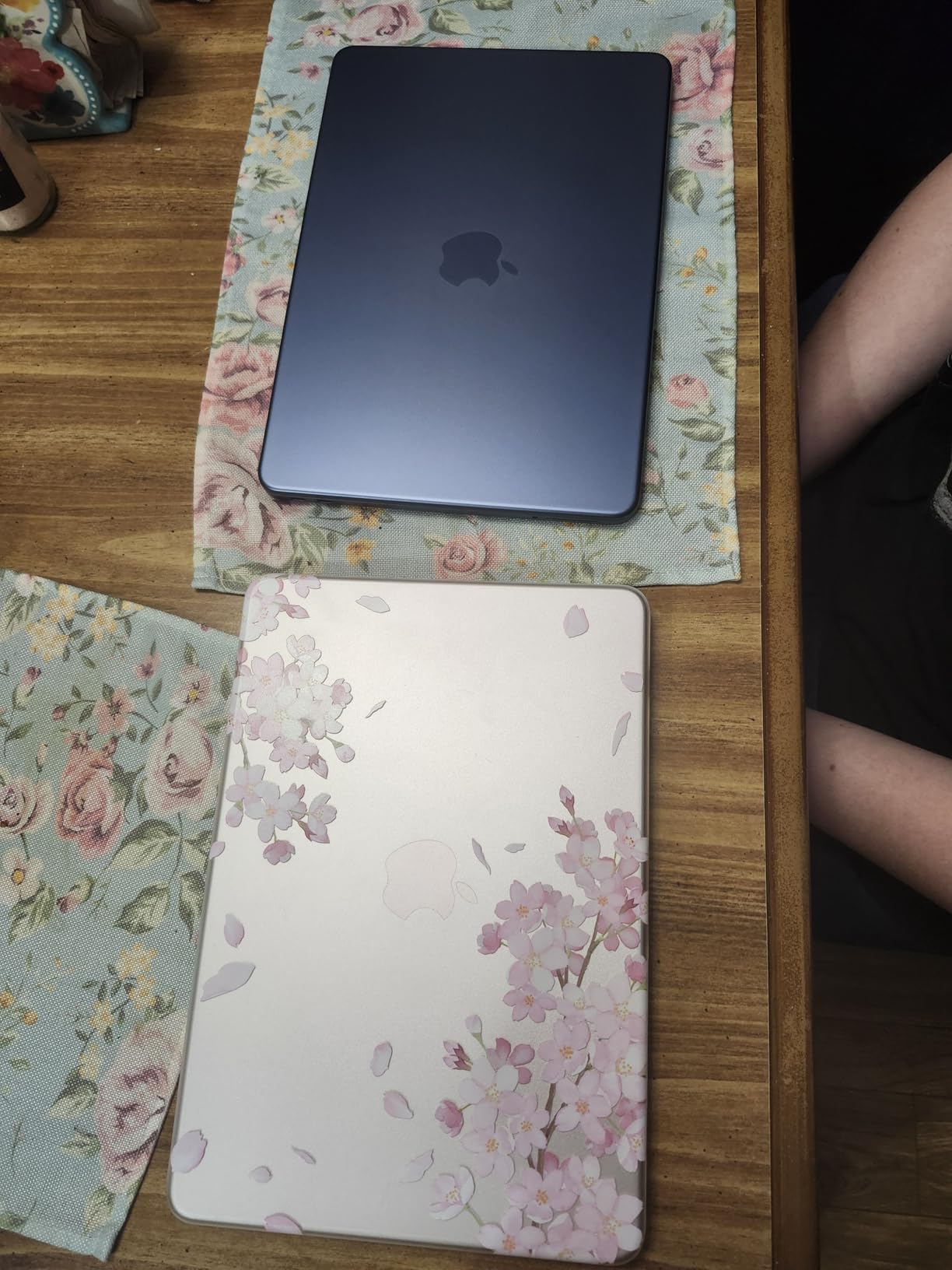 Apple 2026 MacBook Neo 13-inch Laptop with A18 Pro chip: Built for AI and Apple Intelligence, Liquid Retina Display, 8GB Unified Memory, 256GB SSD Storage, 1080p FaceTime HD Camera; Citrus customer photo 1