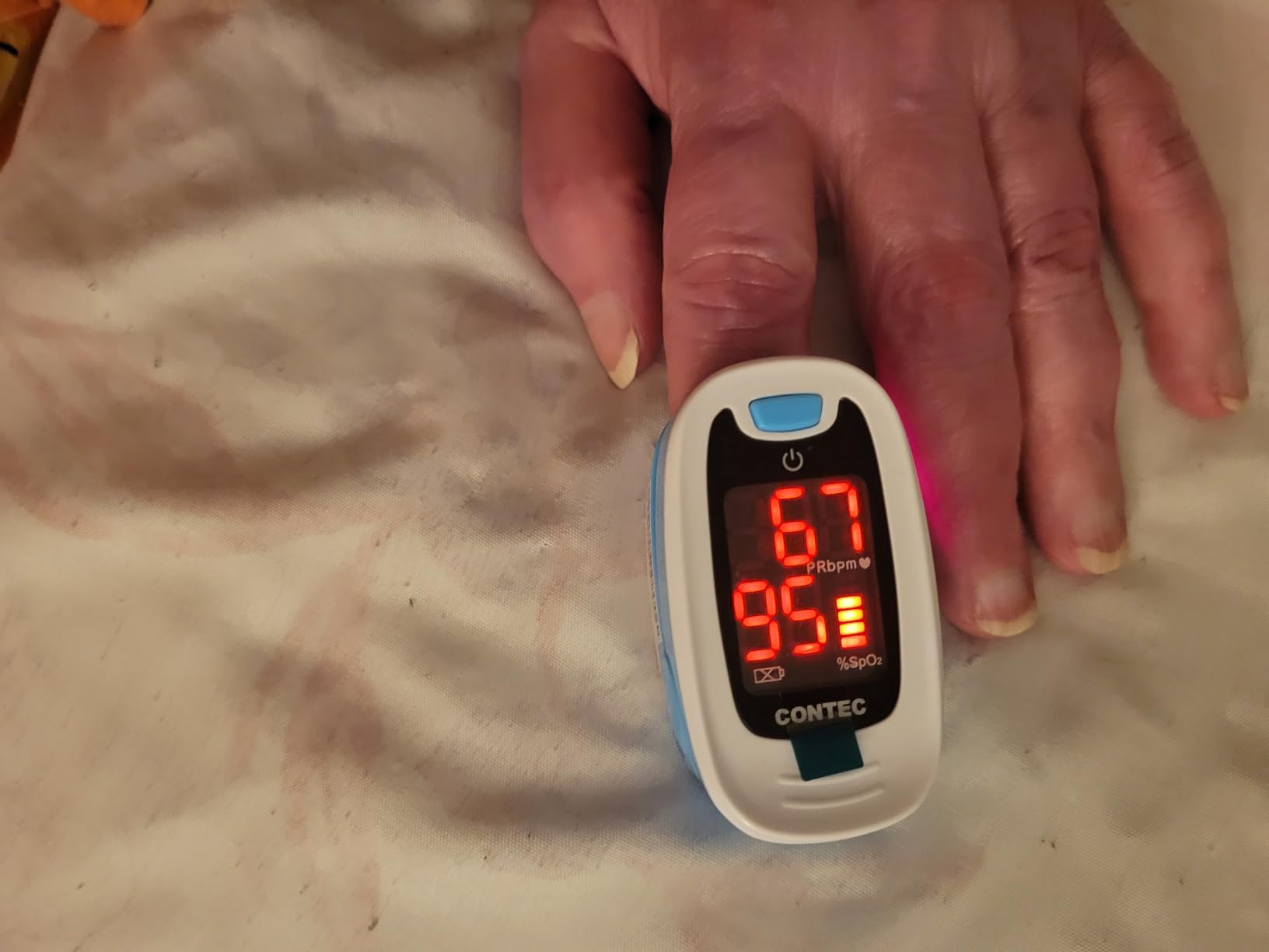 CONTEC Pulse Oximeter, SpO2 & PR Value Blood Oxygen Monitor w/Lanyard customer photo 2