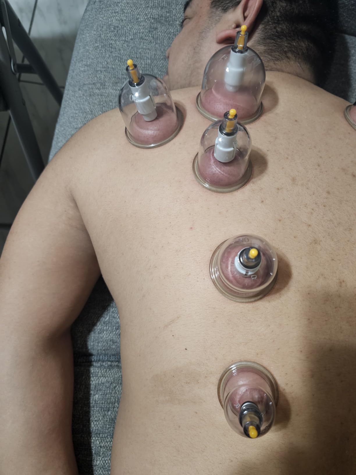 Myofascial Releaser Cupping Set Massager, Cupping Kit for Massage Therapy customer photo 1