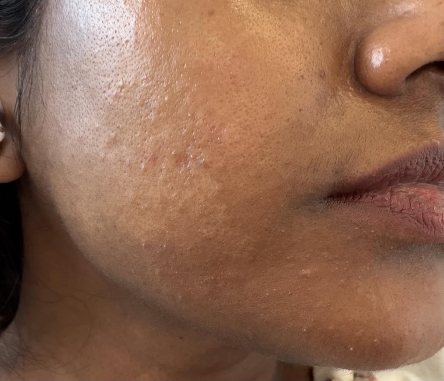 La Roche-Posay Cicaplast Balm B5, Barrier Repair Cream for Dry Skin customer photo 2