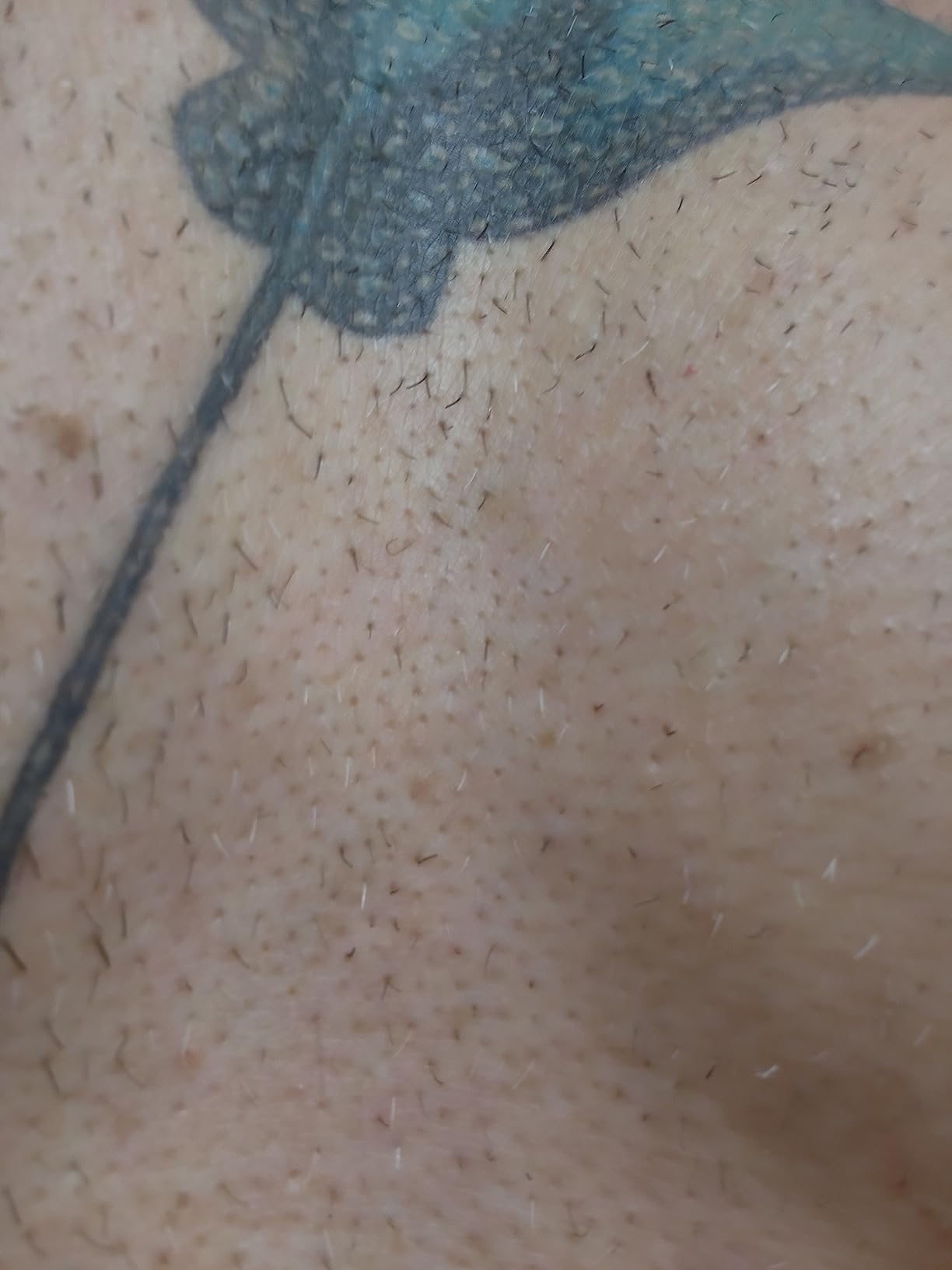 Braun IPL, Silk·Expert Pro 5, IPL Hair Removal for Women and Men, Permanent Laser Hair Reduction At-Home, 4 Heads, IPL5347 customer photo 2